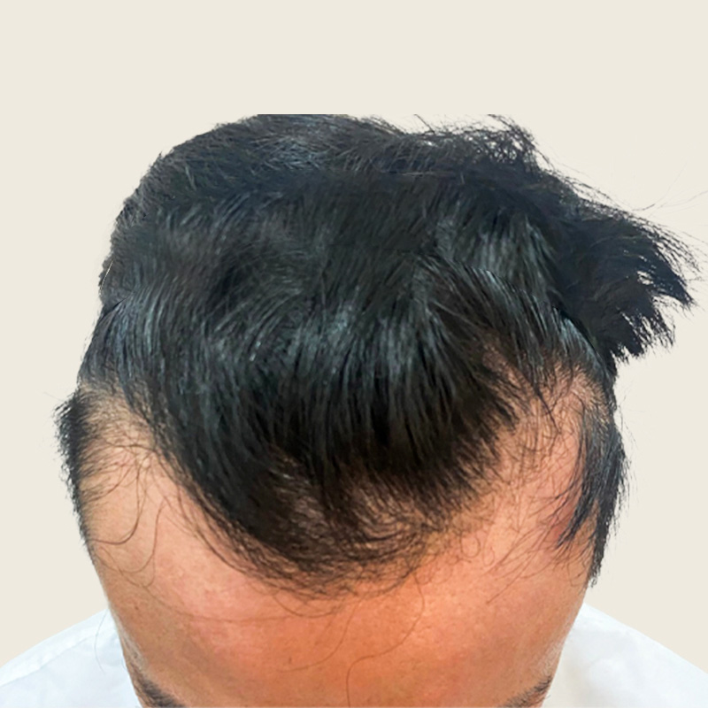 Detalle de cabello antes del procedimiento