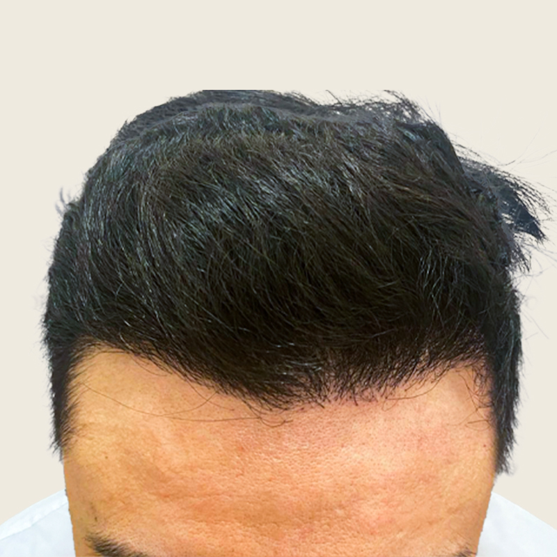 Detalle de cabello después del procedimiento